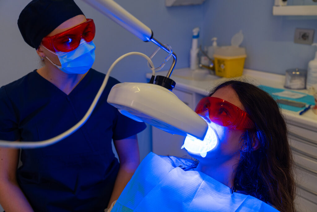 Come funziona sbiancamento denti