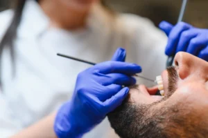 Pulizia dentale e prevenzione carie