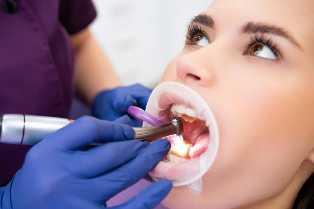 Pulizia dentale e prevenzione carie
